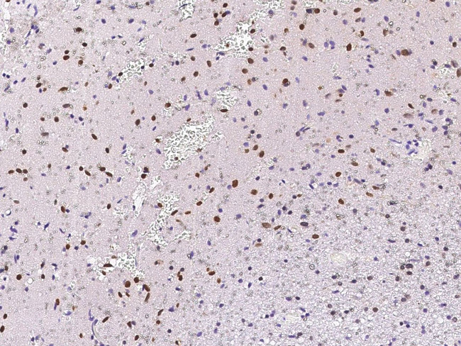 MECP2 Antibody in Immunohistochemistry (Paraffin) (IHC (P))