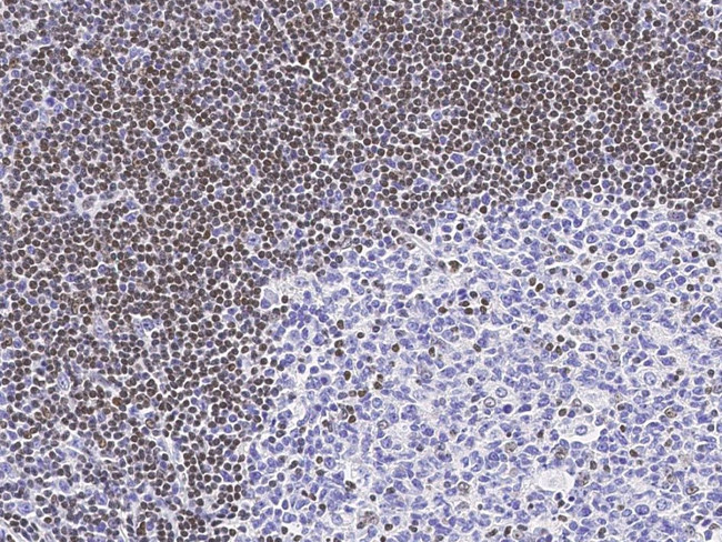 MECP2 Antibody in Immunohistochemistry (Paraffin) (IHC (P))