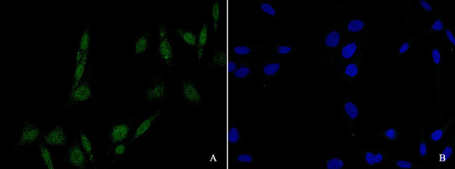 MiTF Antibody in Immunocytochemistry (ICC/IF)