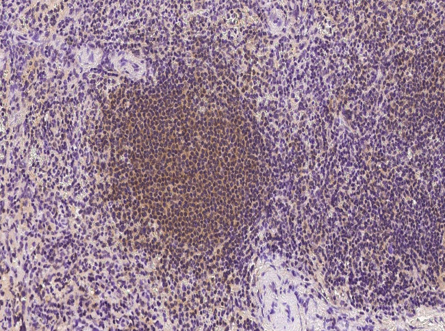 NF2 Antibody in Immunohistochemistry (Paraffin) (IHC (P))