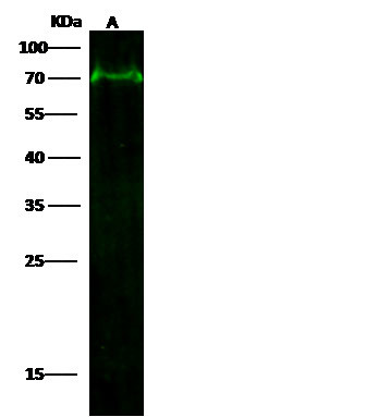 NF2 Antibody in Western Blot (WB)