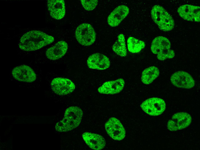 PAX2 Antibody in Immunocytochemistry (ICC/IF)