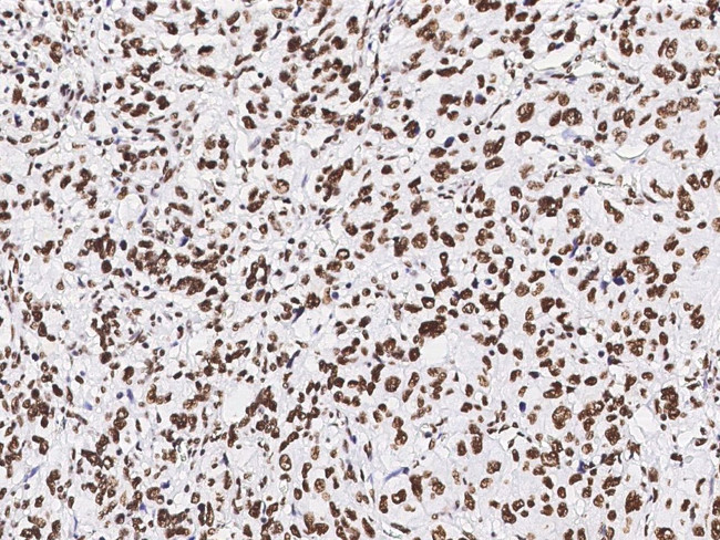 PAX2 Antibody in Immunohistochemistry (Paraffin) (IHC (P))