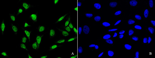 PDCD4 Antibody in Immunocytochemistry (ICC/IF)