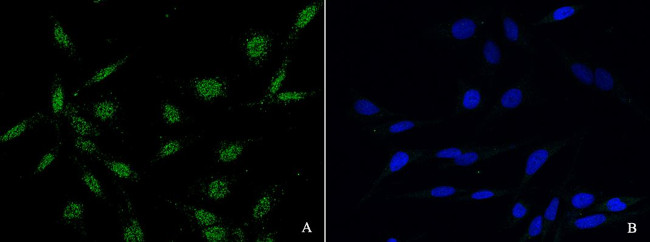 PLK1 Antibody in Immunocytochemistry (ICC/IF)