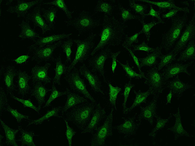 PPP1R8 Antibody in Immunocytochemistry (ICC/IF)