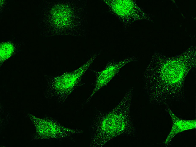 RAD51 Antibody in Immunocytochemistry (ICC/IF)