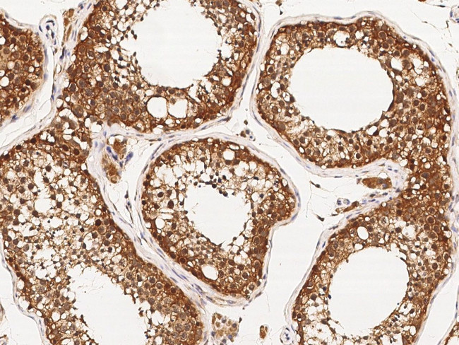 RAD51 Antibody in Immunohistochemistry (Paraffin) (IHC (P))