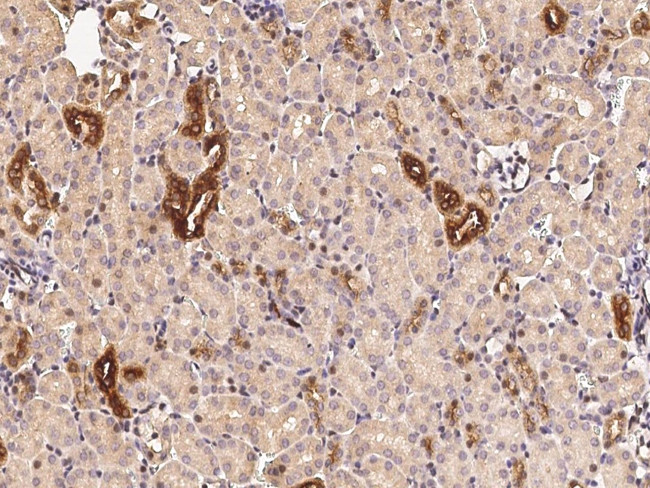 RARB Antibody in Immunohistochemistry (Paraffin) (IHC (P))