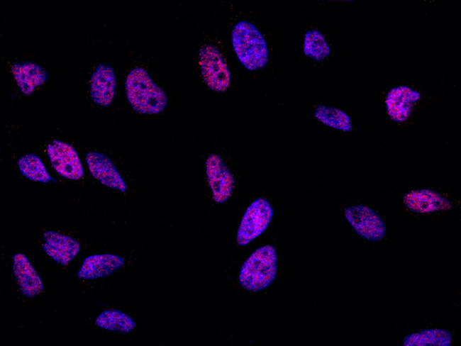 SOX11 Antibody in Immunocytochemistry (ICC/IF)