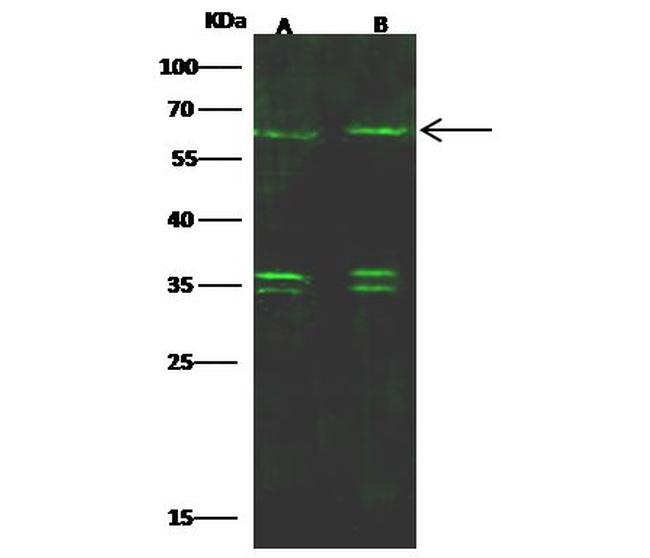 SOX11 Antibody in Western Blot (WB)