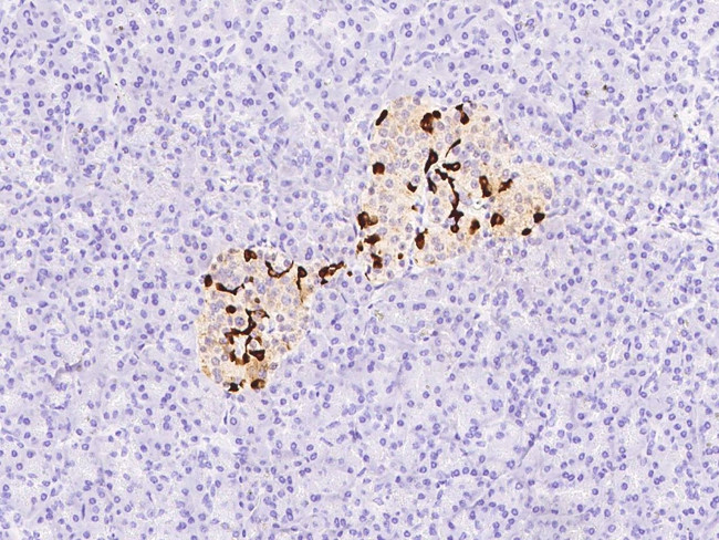 Somatostatin Antibody in Immunohistochemistry (Paraffin) (IHC (P))