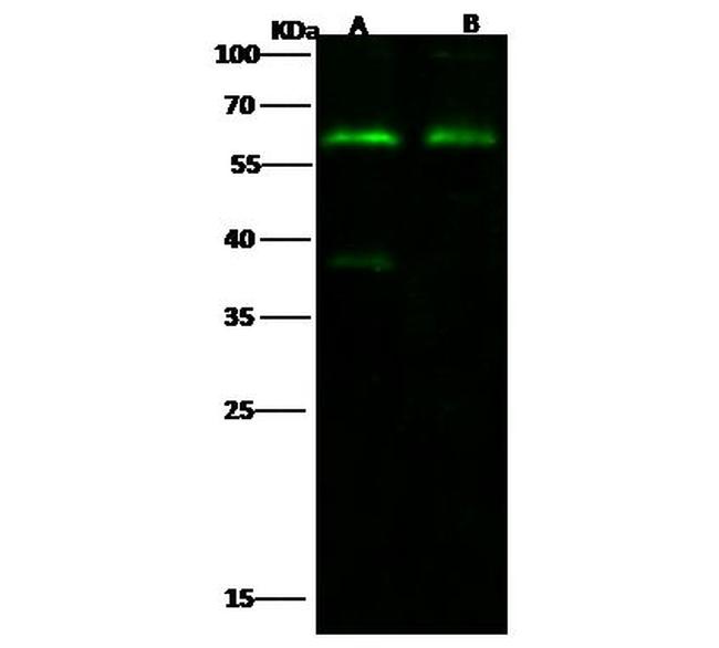 Synaptotagmin 1 Antibody in Western Blot (WB)