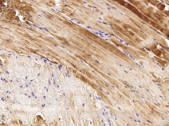 Actin Antibody in Immunohistochemistry (Paraffin) (IHC (P))