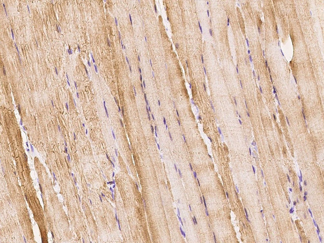 Creatine Kinase MB Antibody in Immunohistochemistry (Paraffin) (IHC (P))