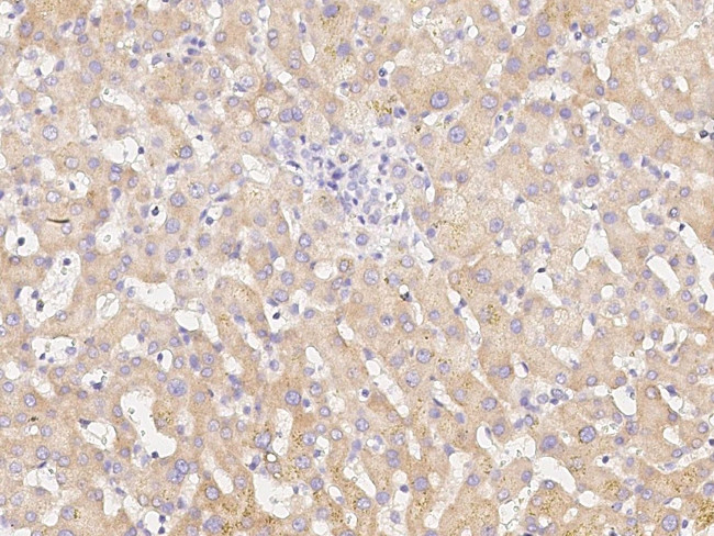 CPT2 Antibody in Immunohistochemistry (Paraffin) (IHC (P))