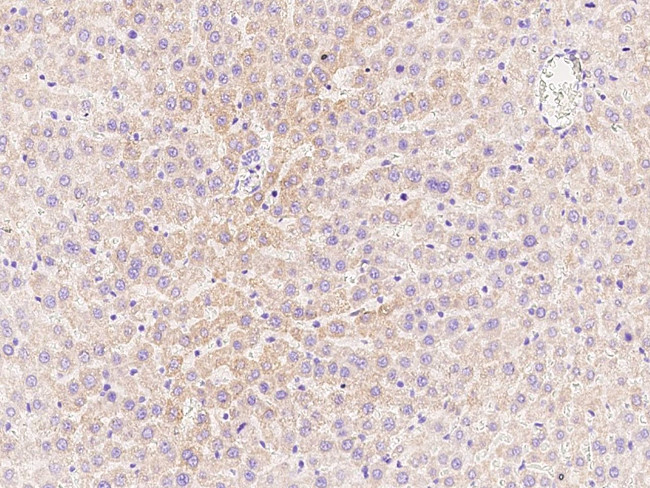 CPT2 Antibody in Immunohistochemistry (Paraffin) (IHC (P))