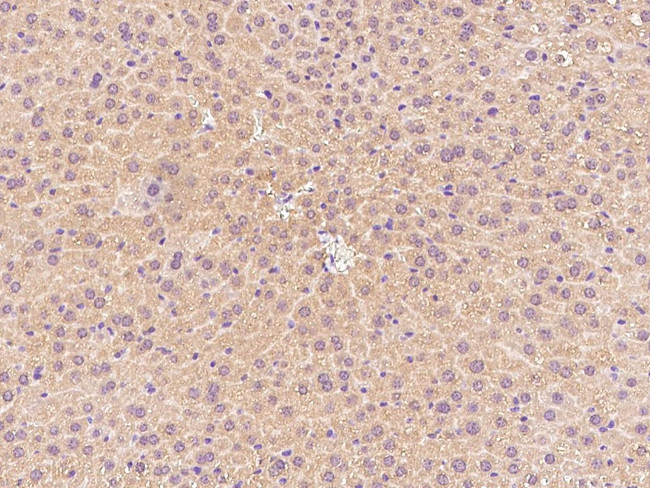 CPT2 Antibody in Immunohistochemistry (Paraffin) (IHC (P))