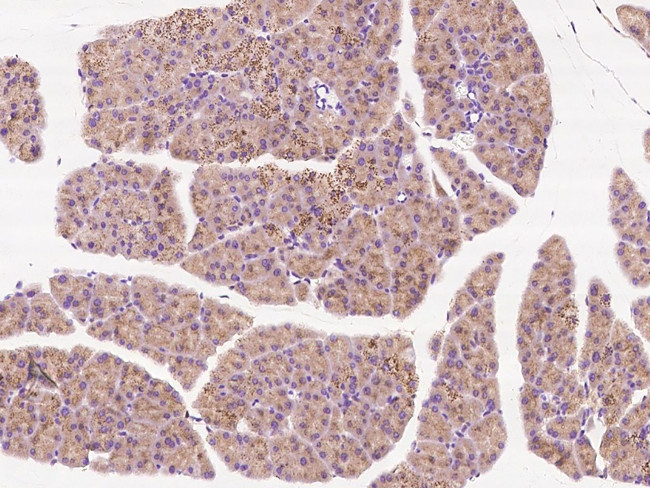 MCTS1 Antibody in Immunohistochemistry (Paraffin) (IHC (P))