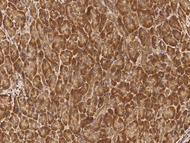 MCTS1 Antibody in Immunohistochemistry (Paraffin) (IHC (P))