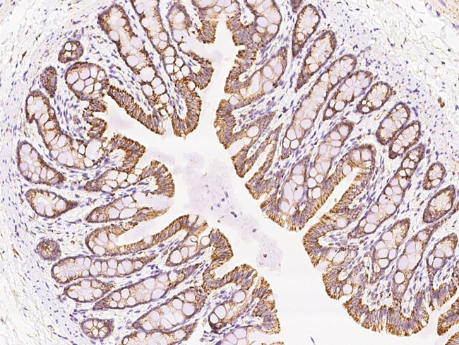 MCTS1 Antibody in Immunohistochemistry (Paraffin) (IHC (P))