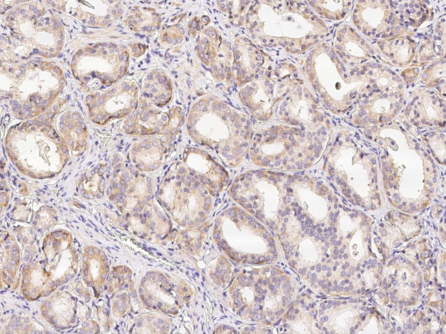 METAP2 Antibody in Immunohistochemistry (Paraffin) (IHC (P))