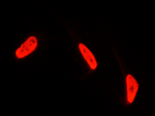 PTBP1 Antibody in Immunocytochemistry (ICC/IF)