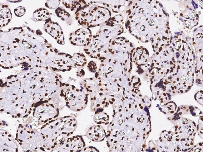 PTBP1 Antibody in Immunohistochemistry (Paraffin) (IHC (P))