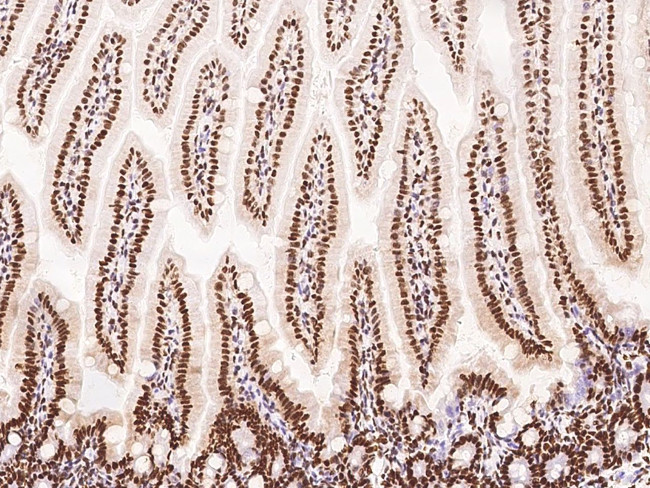 PTBP1 Antibody in Immunohistochemistry (Paraffin) (IHC (P))