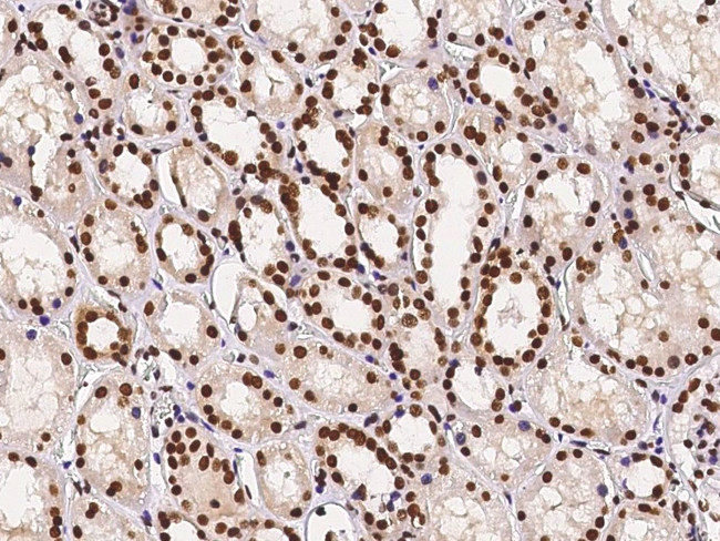 PTBP1 Antibody in Immunohistochemistry (Paraffin) (IHC (P))