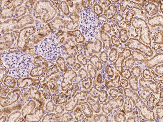 ADAM10 Antibody in Immunohistochemistry (Paraffin) (IHC (P))