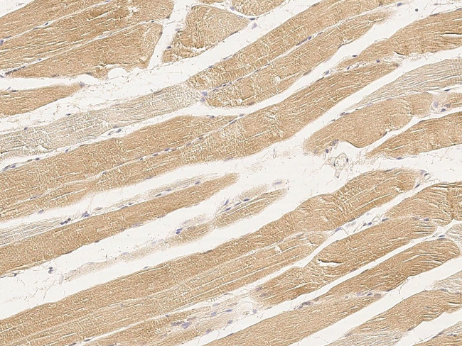 AMPK alpha-2 Antibody in Immunohistochemistry (Paraffin) (IHC (P))