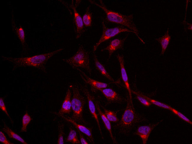 GLUT4 Antibody in Immunocytochemistry (ICC/IF)