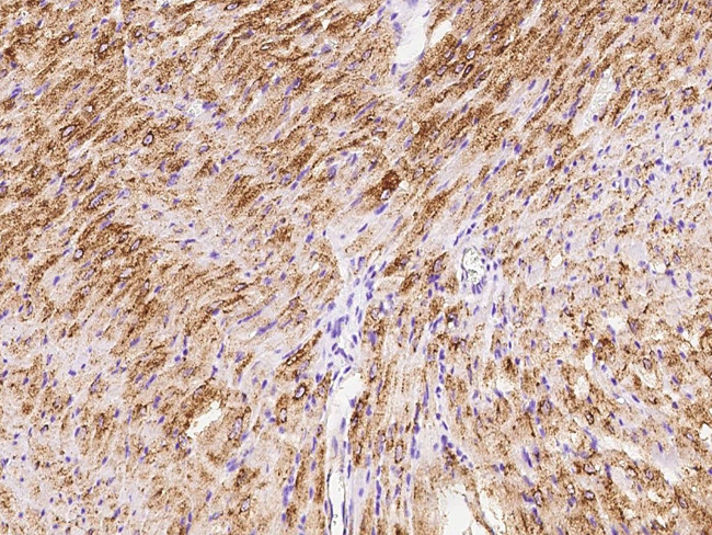 GLUT4 Antibody in Immunohistochemistry (Paraffin) (IHC (P))