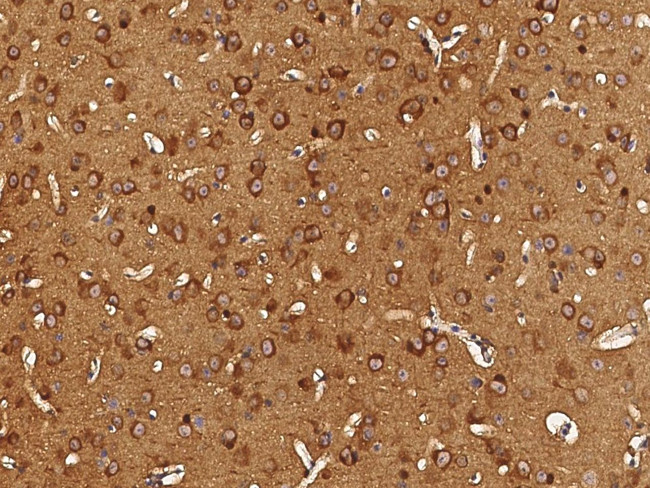 Aminoacylase Antibody in Immunohistochemistry (Paraffin) (IHC (P))