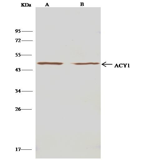 Aminoacylase Antibody in Immunoprecipitation (IP)