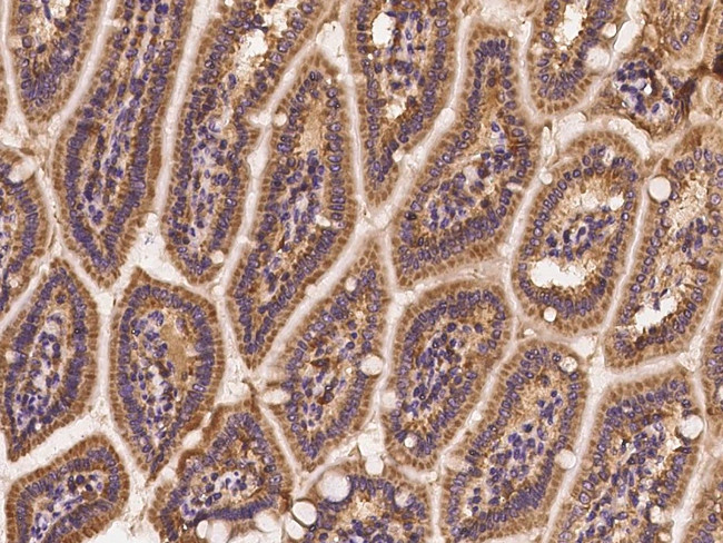 AKT2 Antibody in Immunohistochemistry (Paraffin) (IHC (P))