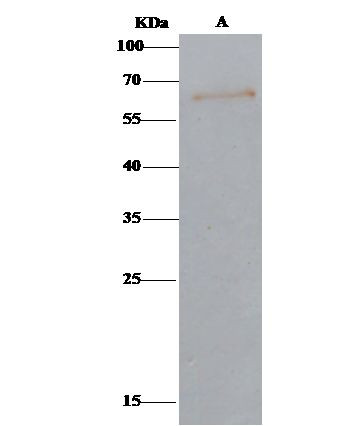 Arylsulfatase A Antibody in Immunoprecipitation (IP)