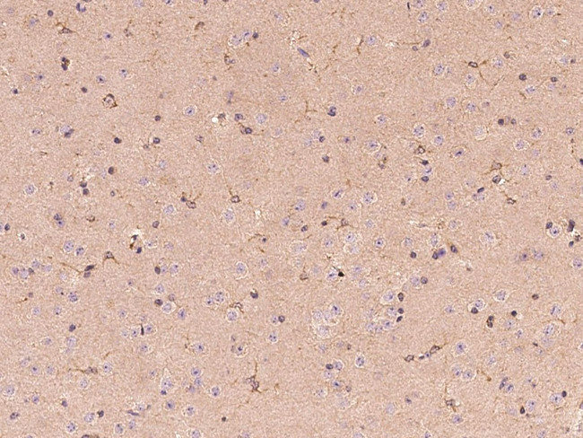 Butyrylcholinesterase Antibody in Immunohistochemistry (Paraffin) (IHC (P))