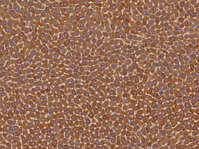 Butyrylcholinesterase Antibody in Immunohistochemistry (Paraffin) (IHC (P))