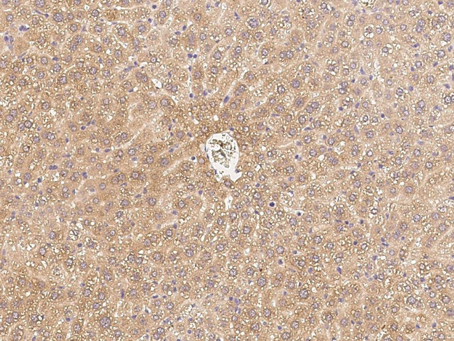 C1QB Antibody in Immunohistochemistry (Paraffin) (IHC (P))