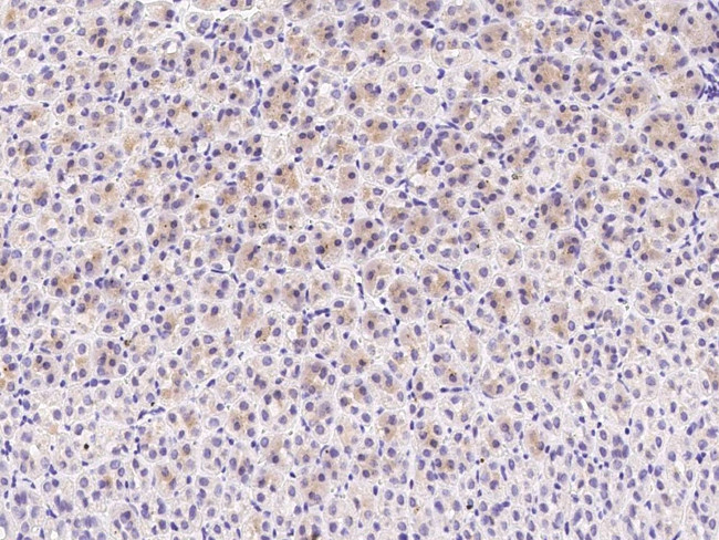 C1QB Antibody in Immunohistochemistry (Paraffin) (IHC (P))