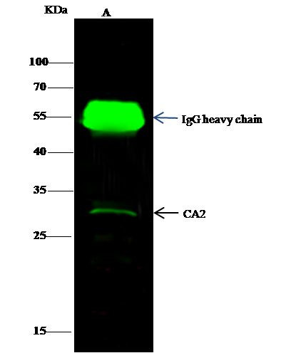 Carbonic Anhydrase II Antibody in Immunoprecipitation (IP)