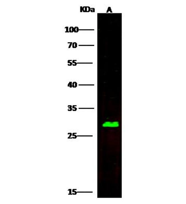 Carbonic Anhydrase II Antibody in Western Blot (WB)