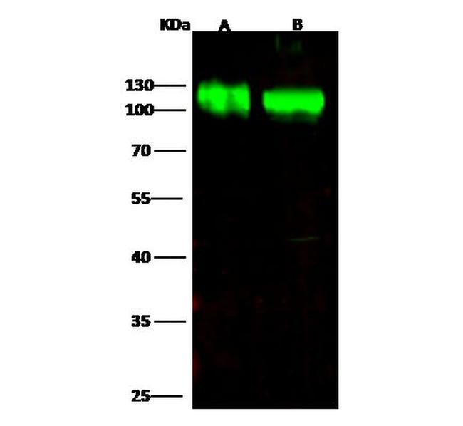 B7-H3 Antibody in Western Blot (WB)