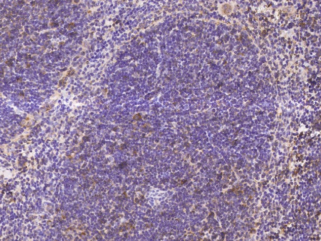 CD28 Antibody in Immunohistochemistry (Paraffin) (IHC (P))