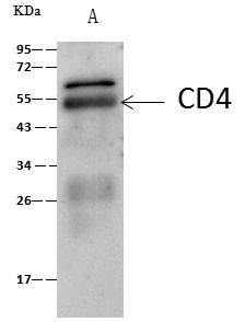 CD4 Antibody in Immunoprecipitation (IP)