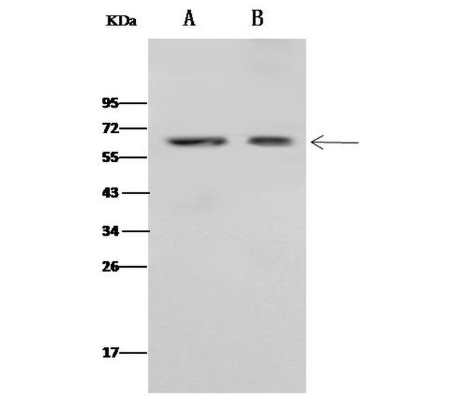 CD4 Antibody in Western Blot (WB)