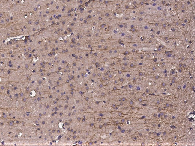 CD59 Antibody in Immunohistochemistry (Paraffin) (IHC (P))