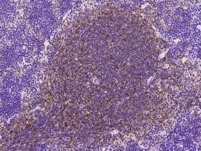 CD93 Antibody in Immunohistochemistry (Paraffin) (IHC (P))